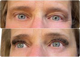 More amazing before and afters.