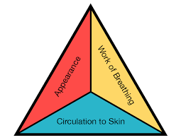 Image result for Pediatric Assessment Triangle