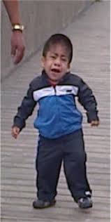 Home Treatment Of Type Vi Mucopolysaccharidosis Maroteaux Lamy Syndrome An Alternative At This Time Of Covid 19 Pandemic A Case In Peru Cortez Miranda 2020 Clinical Case Reports Wiley Online Library