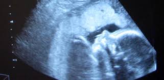 نتیجه جستجوی لغت [abort] در گوگل