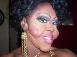 15 Examples Of Plastic Surgery Gone Horribly Wrong Lovelyish Plastic Surgery Gone Wrong Plastic Surgery Bad Plastic Surgeries