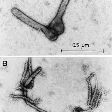 Ebola virus an rna virus almost identical to the marburg virus but serologically distinct; A B Electron Microscopic Appearance Of Marburg Virus Stained By Download Scientific Diagram