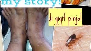 Gigitan kutu kucing dapat menyebabkan reaksi alergi pada hewan peliharaan dan manusia. Jangkitan Kucing Yang Boleh Menyebar Ke Manusia Penyakit Berjangkit 2021