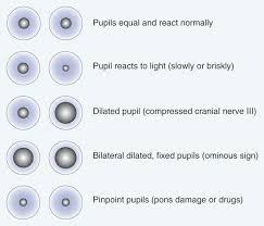 perrla variations study sesh nursing assessment health