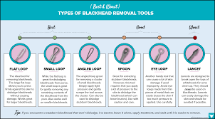 blackhead removal tools treatments the ultimate guide