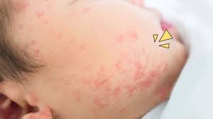 We did not find results for: Ini 5 Penyebab Bintik Merah Pada Bayi Yang Umum Terjadi Orami