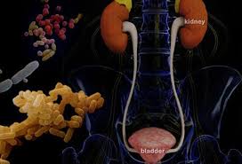 Urinary Tract Infection Uti Symptoms Causes Treatment Home Remedies