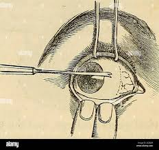Image result for artistic divergence eyeballs