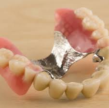 They used to be made of porcelain or ceramic. Dentures Warren Mi Sparkle Dental