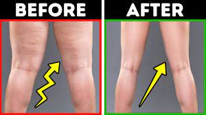 Explore yoga, barre, pilates, weight training, core, hiit & more. 11 Easy Exercises To Slim Your Legs In 2 Weeks Youtube