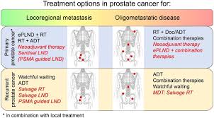 Surviving prostate cancer cells have become evident again on evaluation. Prostate Specific Membrane Antigen Guided Surgery Journal Of Nuclear Medicine