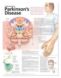 understanding parkinson s disease anatomical chart 2nd edition