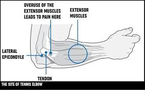 Pin On Health