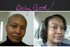 SURVIVORS! 🩷🩷 Two sisters. Two breast cancer diagnoses. Both in their  20s. Kate and Elizabeth Singletary's bond only grew stronger through the  fight of their lives — and genetic testing played a