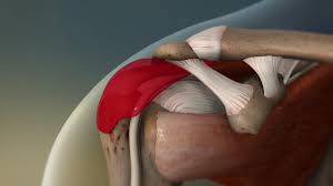 Image result for Bursitis