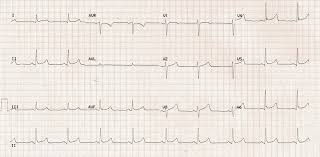 Image result for J Wave