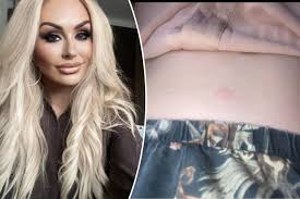 I bought fake Ozempic to rid belly fat — it felt like my heart was going to  explode