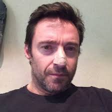 Hugh Jackman