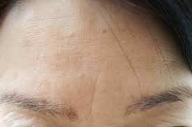 ボード 眉間 のピン