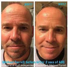 Rodan and Fields Skin Care: Mary Hammack, Independent Consultant