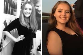 Gracie Bons Plastic Surgery Confession Will Shock You - Truth or Fiction