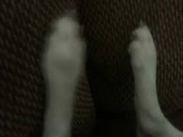 Dog Restless Leg Syndrome Youtube