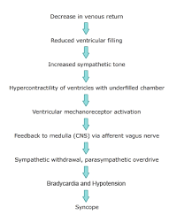Image result for Syncope