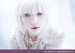 An Albino Model Nastya Zhidkova Funsubstance Albino Model Albino Girl Violet Eyes