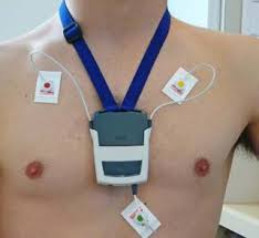 Bei einem elektrokardiogramm erfolgt die aufzeichnung. Langzeit Ekg Herzpraxis Winterthur