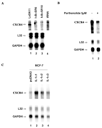 Unfortunately, breast cancer can come back years after beating the disease, and it's vital that women recognize the subtle signs that a cancer has spread to the bones. Nf K B Promotes Breast Cancer Cell Migration And Metastasis By Inducing The Expression Of The Chemokine Receptor Cxcr4 Journal Of Biological Chemistry