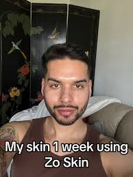 Zo Skincare Routine Before After