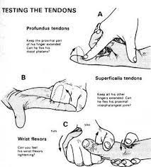 Testing fdp abbreviation meaning defined here. Testing Tendons Occupational Therapy Hand Therapy Massage Therapy
