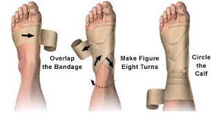 How To Use An Elastic Bandage Care Guide Medical Knowledge Allina Health Medical