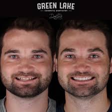 Green Lake Cosmetic Dentistry