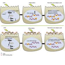 Colorectal cancer syndrome should be referred to a clinical genetics service for genetic risk assessment, where accessible. Suppression Of Elf4 In Ulcerative Colitis Predisposes Host To Colorectal Cancer Sciencedirect