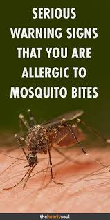 Pin On Allergies