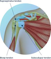 Infraspinatus and teres minor tendon. Tendonitis Of The Shoulder Clinica Do Joelho E Ombro Prof Gutierres Medicos E Ortopedia