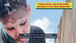 German health system