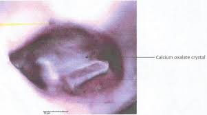 Image result for Fadogia cienkowskii