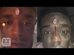 Feb 04, 2021 · lil uzi vert's decision to embed a diamond in the middle of his forehead could turn fatal if it isn't removed correctly. Lil Uzi Vert Gets Diamond Piercing In Forehead Youtube