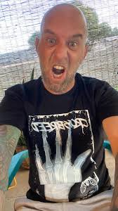 Looks like someone (James Rietz) got the shirt made he wanted of his broken  hand he rocked for you at Rock Fest and Inkcarceration Festival because who  the F doesn't want one