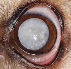 Cataracts are cloudy areas in the lens of the eye that can cause changes in vision. Cataracts Acvo Public
