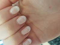 Diskutiere lösen sich gelnägel schnell? Gelnagel Losen Sich Nach Wenigen Tagen