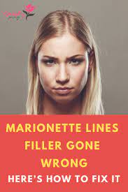 Increasing your daily intake of vitamin c is the best way to get rid of marionette lines around mouth. How To Get Rid Of Marionette Lines Arxiusarquitectura