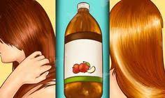 как избавиться от перхоти и выпадения волос в домашних условиях Kak Izbavitsya Ot Vypadeniya Volos Perhoti Lomkosti Perhot Uksus Dlya Volos Sredstva Ot Vypadeniya Volos