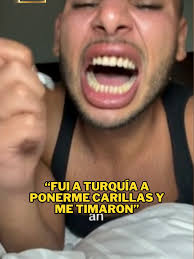 Experiencia dental en Turquía: Descontento por servicios excesivos y altos  precios