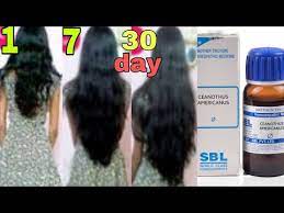 Certified homeopath studies the case history of a patient in detail and finds the origin of the issue. Homeopathy Treatment For Hair Loss Youtube