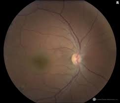 Image result for Chorisochora transvaalensis