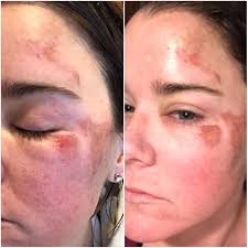 Ann Nance McManus, PA-C