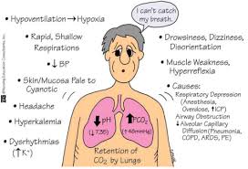 42b2b0a611076202dbe75138a5f23bb7 Png 500 341 Pixels Respiratory Acidosis Nurse Manager Nursing Mnemonics